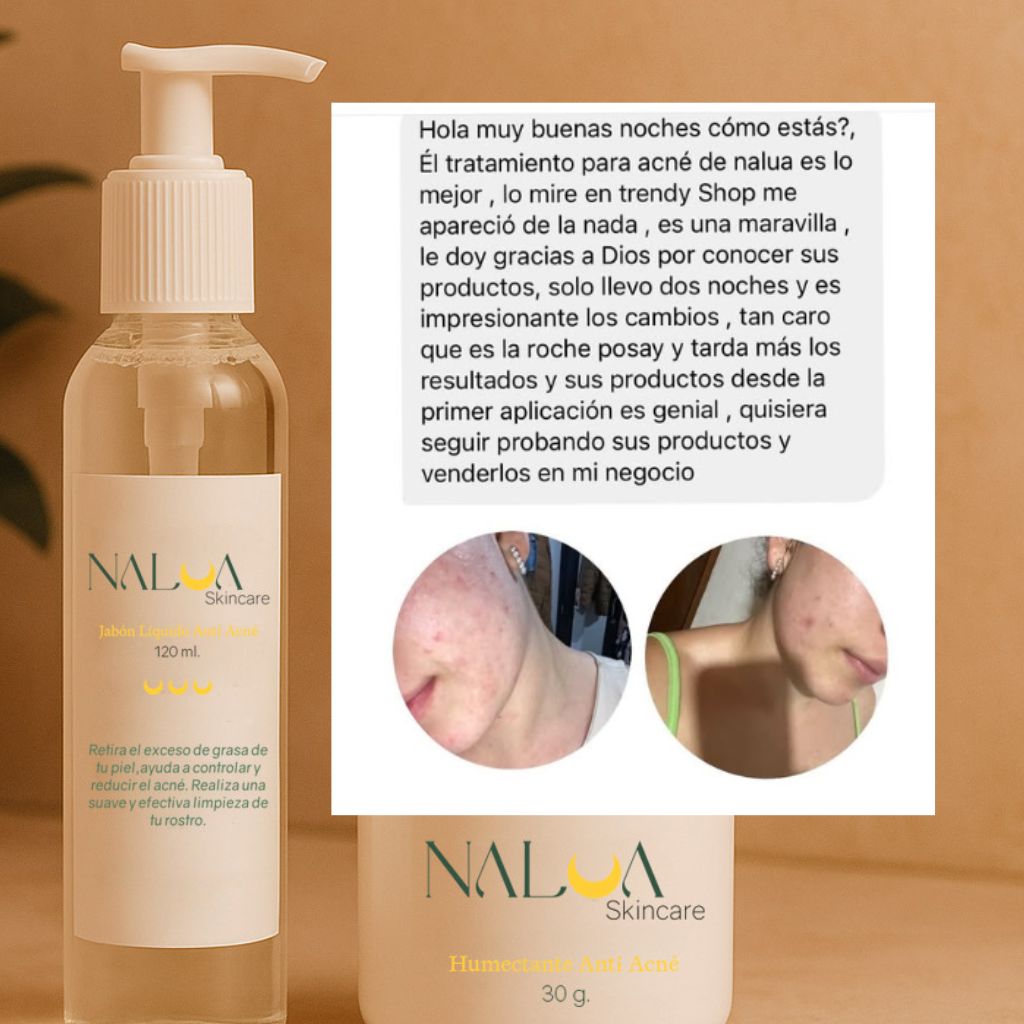 Gel limpiador Anti Acné + Crema humectante de REGALO