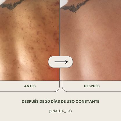 Gel limpiador Anti Acné + Crema humectante Anti Acné