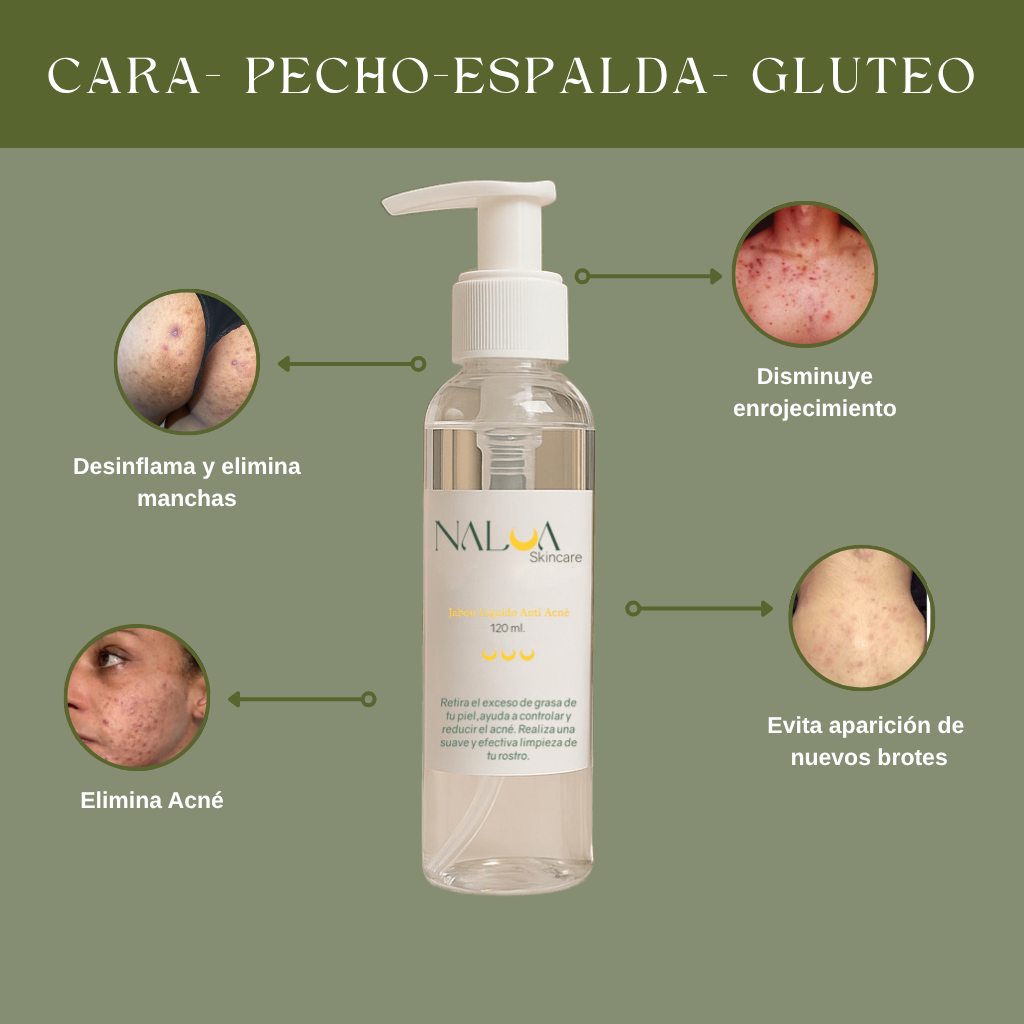 Jabón Liquido Anti Acné