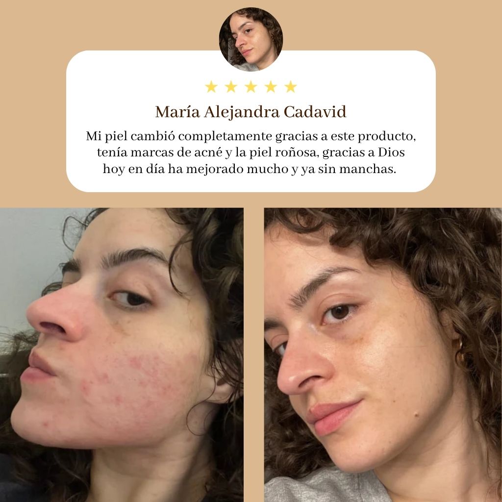 Oro Liquido Anti Edad y Anti Manchas