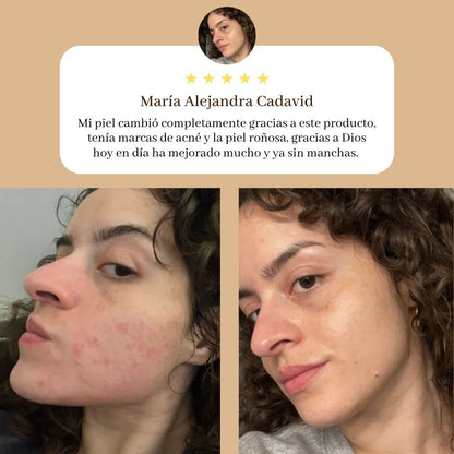 Oro Liquido Anti Edad y Anti Manchas