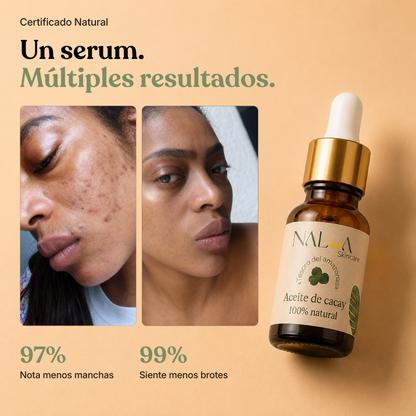 Serum Anti acné y Anti Manchas 2x1 PROMOCIÓN